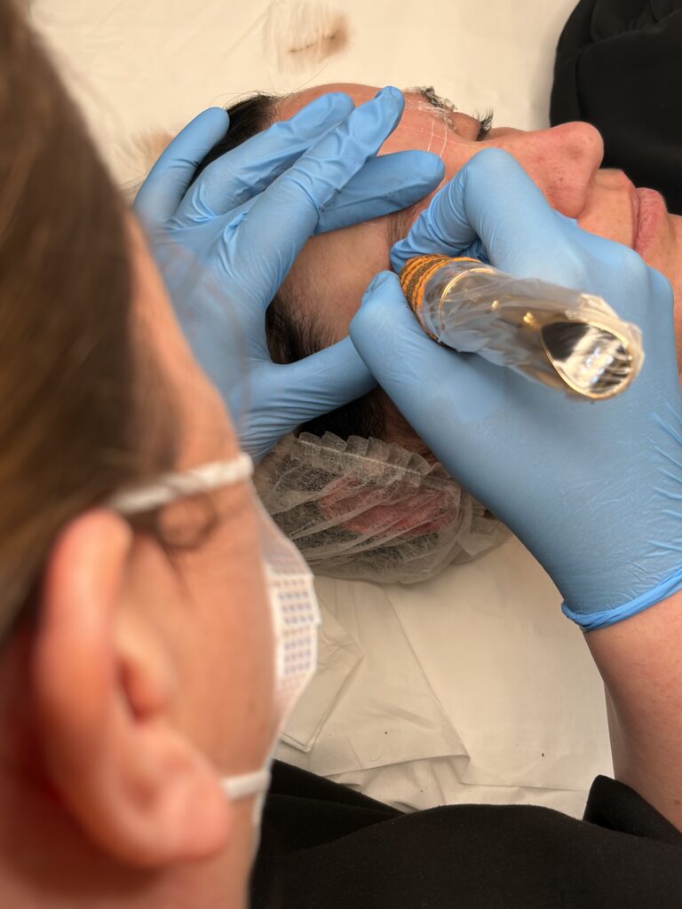 Maquillage d'un sourcil en dermopigmentation